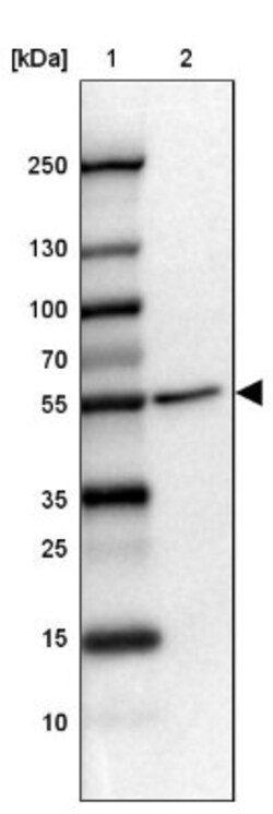 FOXRED1 Antibody, Novus Biologicals 0.1mL; Unlabeled:Antibodies, Polyclonal